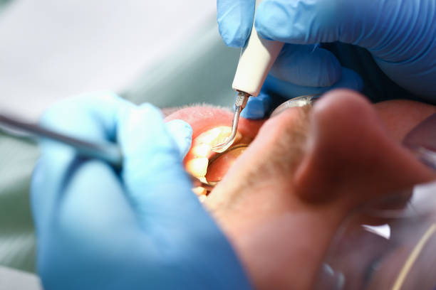 Best Walk-In Emergency Dental Services in Mledgevle, IL