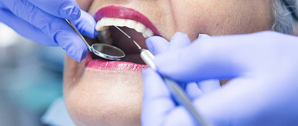 Best Emergency Care for Gum Disease in Mledgevle, IL